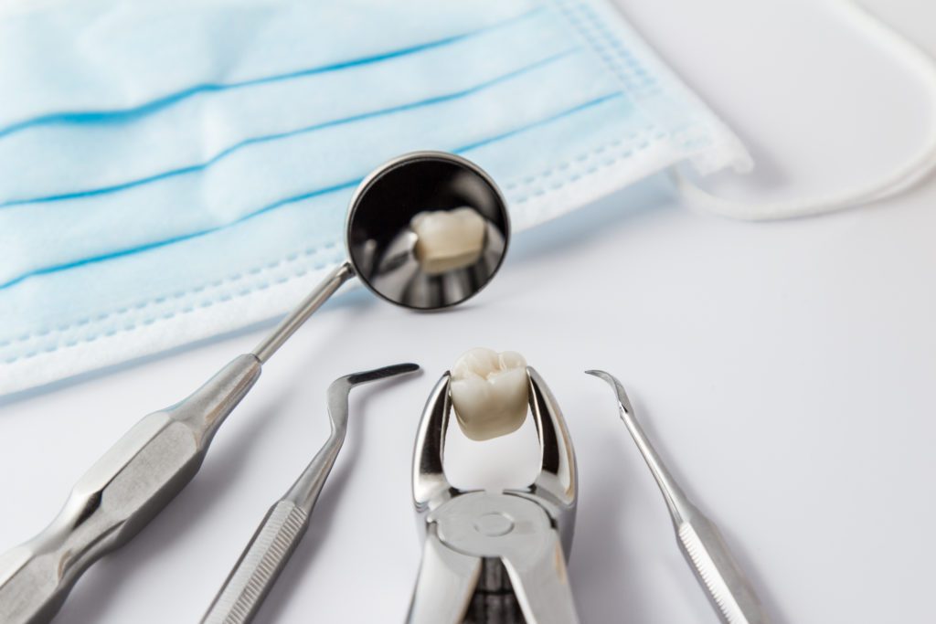 Tooth Extraction in Marriottsville, Maryland